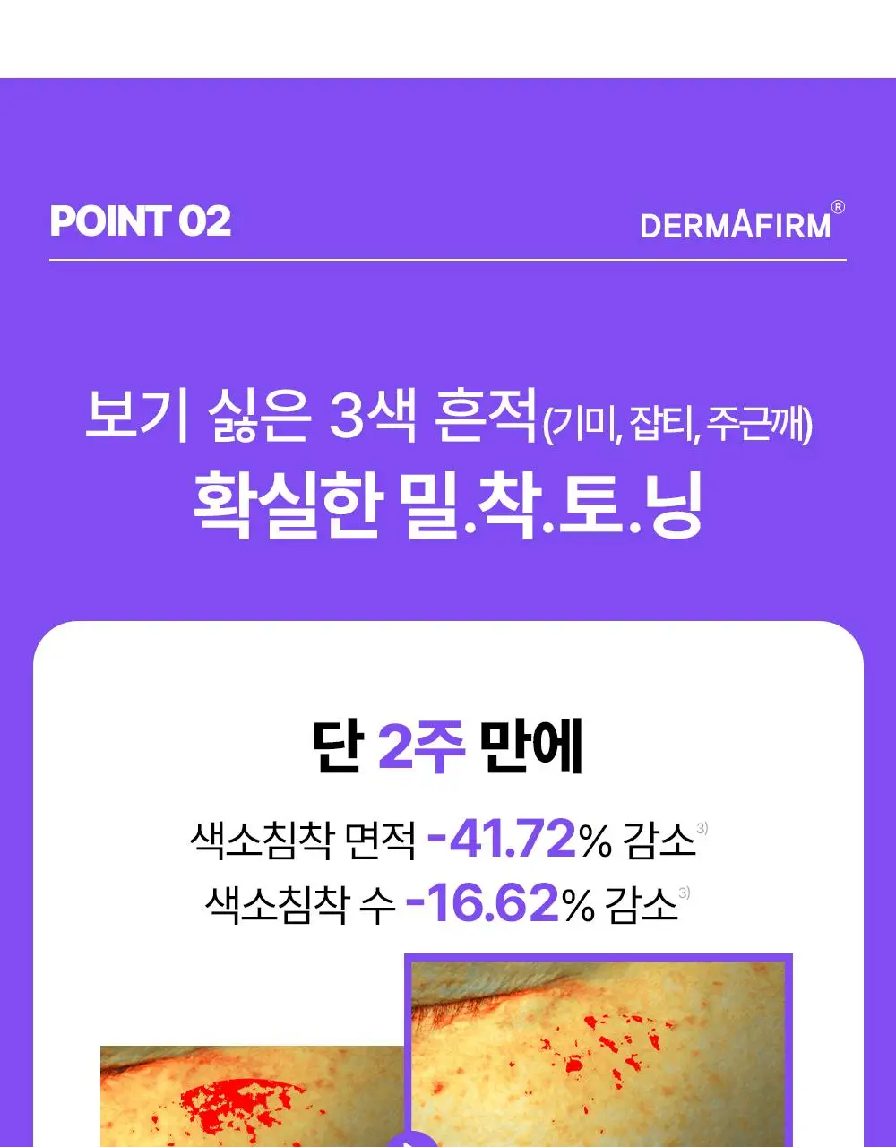 [나띠PICK][흔적케어크림] 더마펌 수딩 리페어 토닝 크림 R4 50ml 기획 (+30ml) 상세페이지 22
